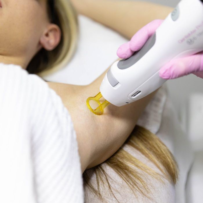 Laser Hair Removal in Andover MA VAIN Medi Spa